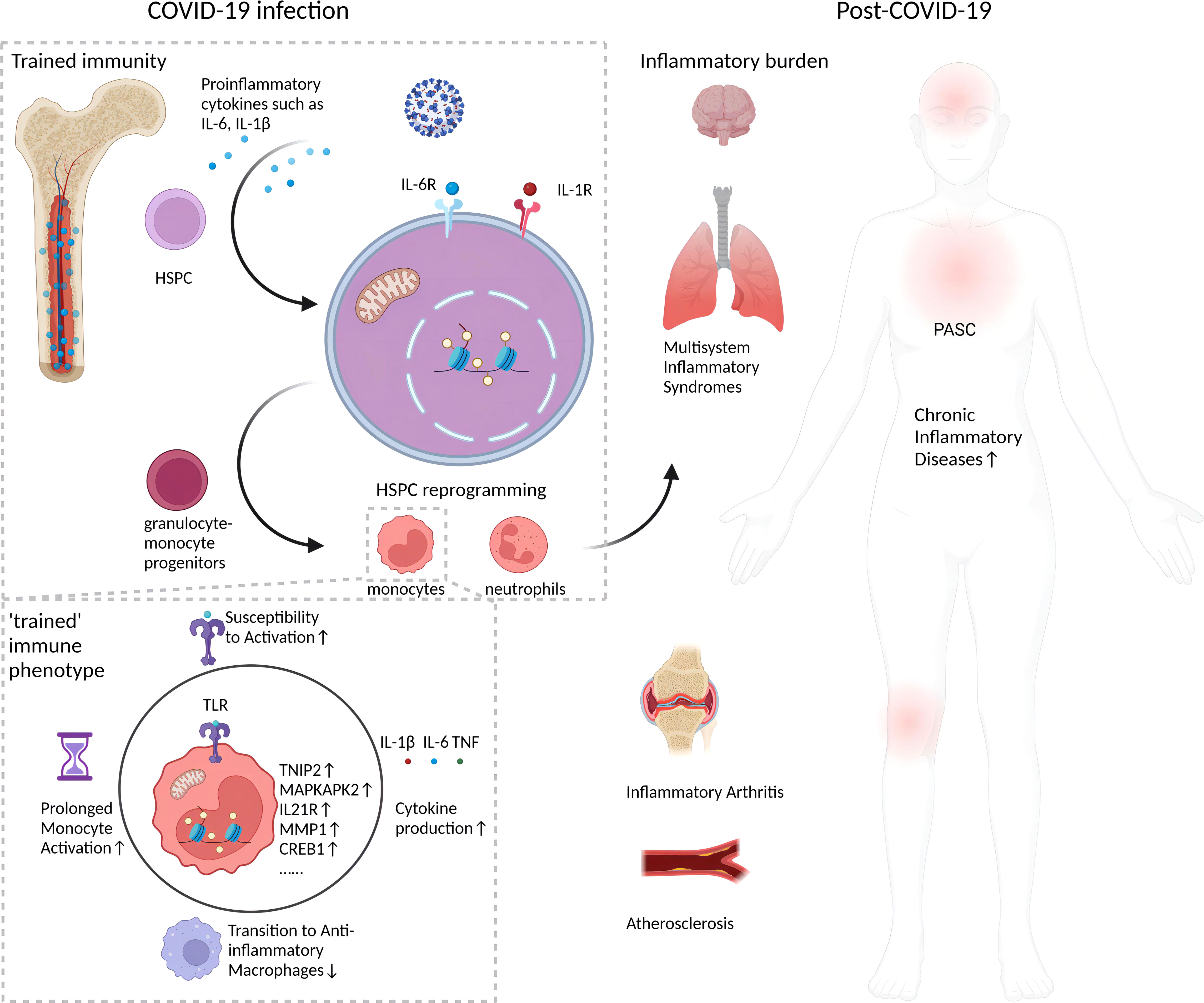 Severe COVID-19 may lead to long-term innate immune system changes