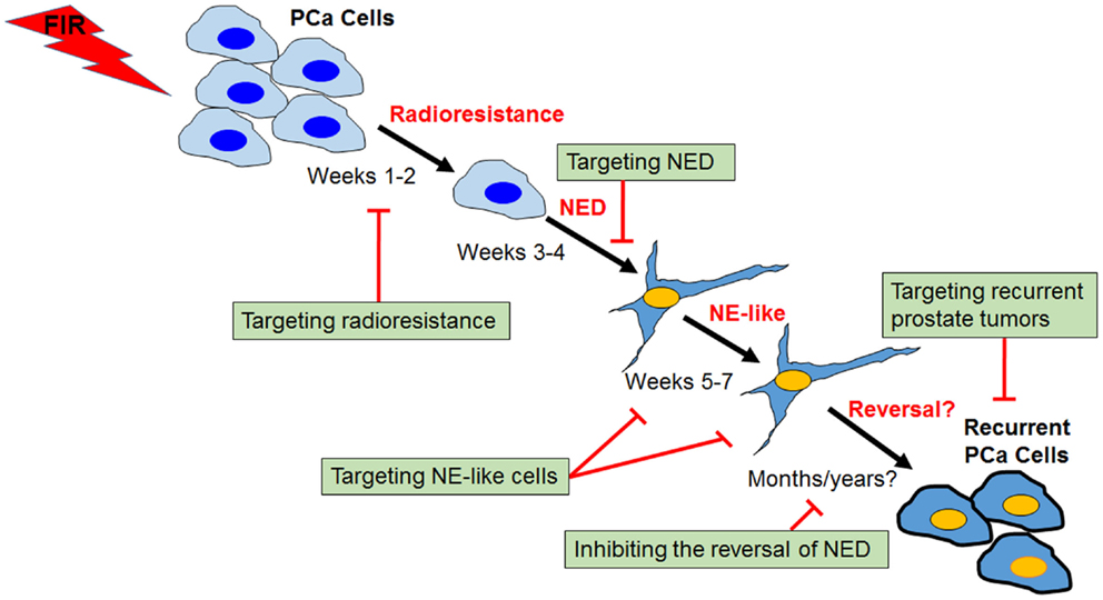 neuroendocrine cancer of prostate forever aloe vera gel weight loss reviews