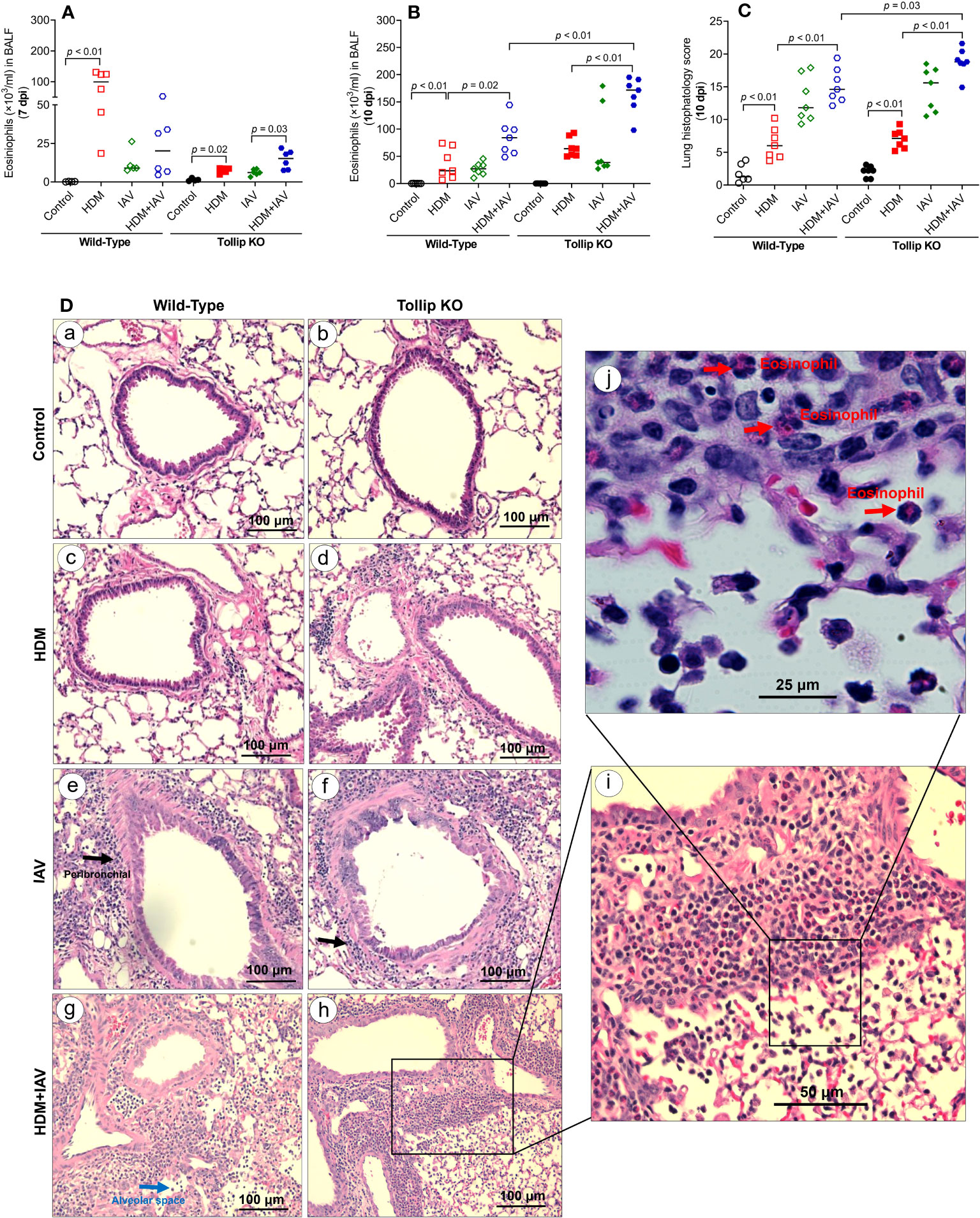 Frontiers | tollip deficiency exaggerates airway type 2 inflammation in