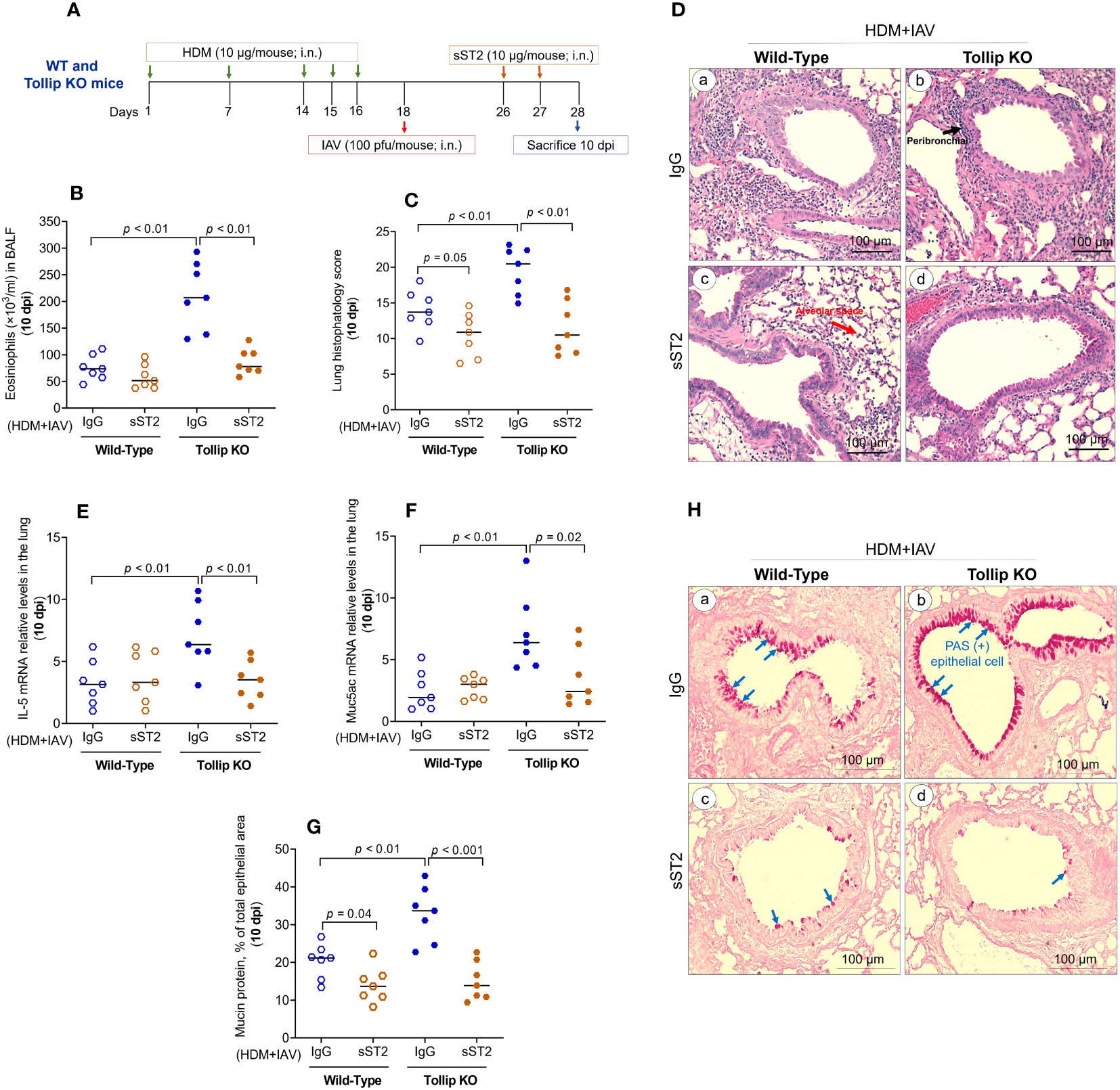 Frontiers | tollip deficiency exaggerates airway type 2 inflammation in