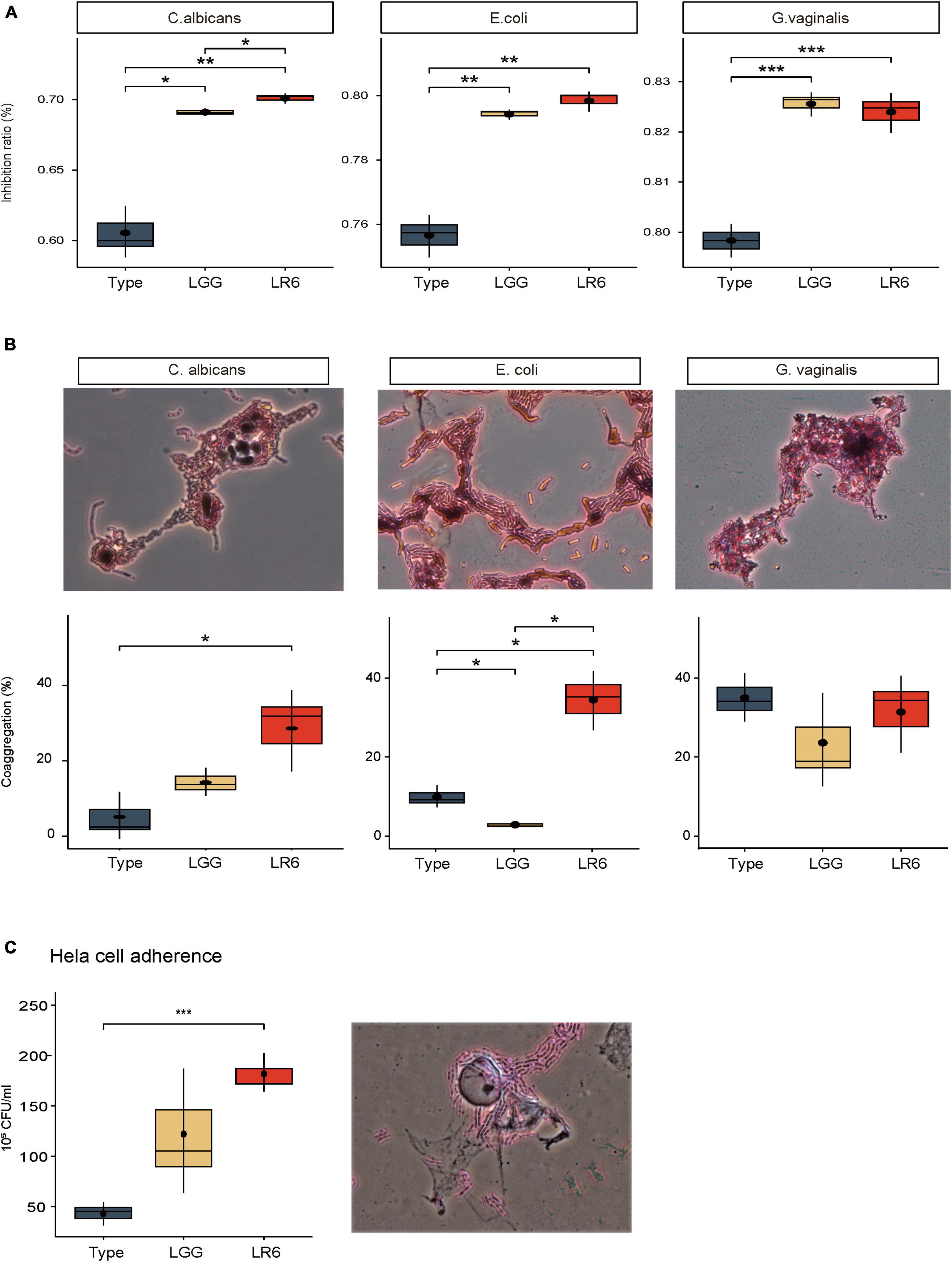 Lacticaseibacillus rhamnosus GR-1, a.k.a. Lactobacillus rhamnosus GR-1:  Past and Future Perspectives: Trends in Microbiology