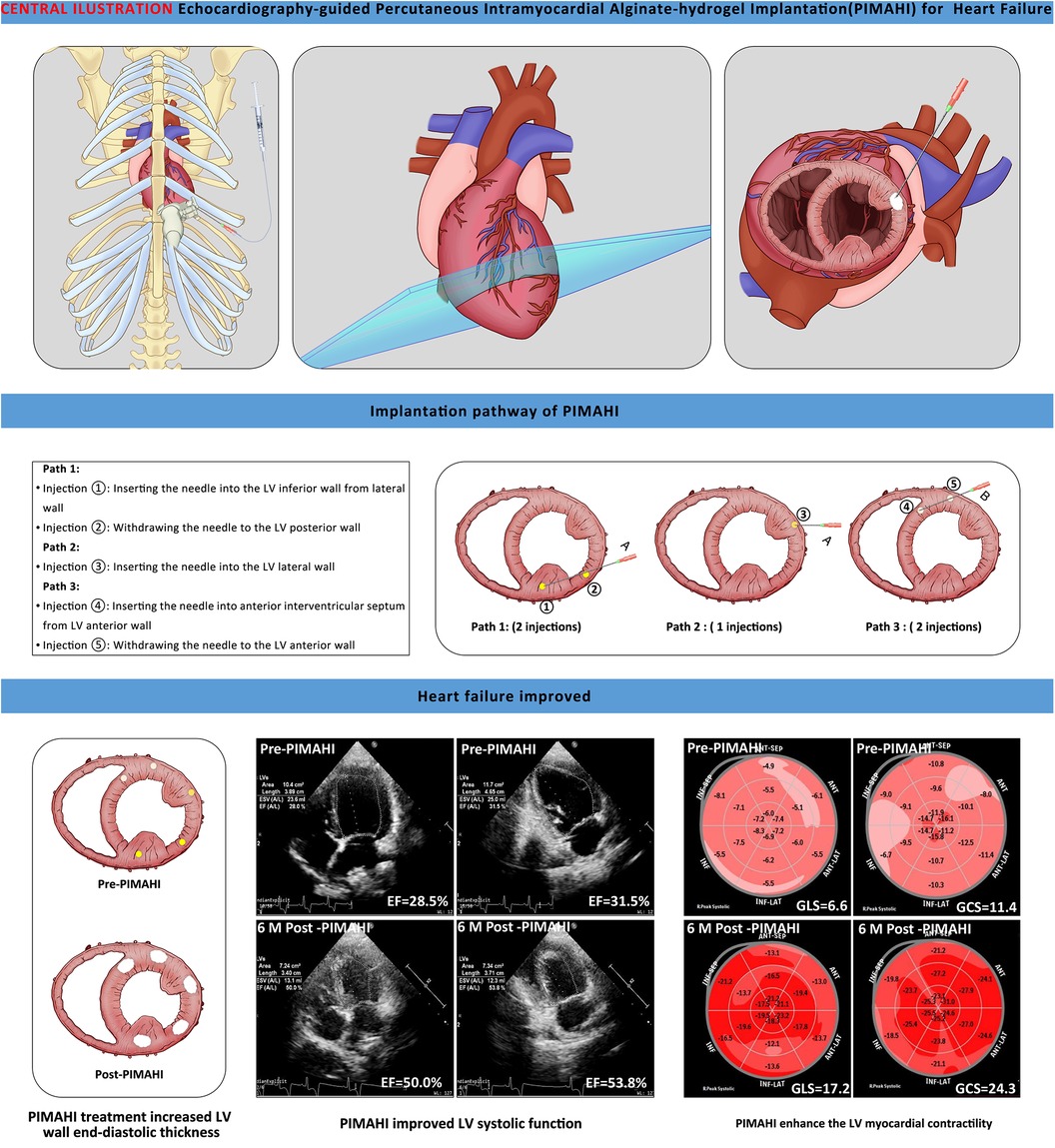 Alginate and alginate composites for biomedical applications