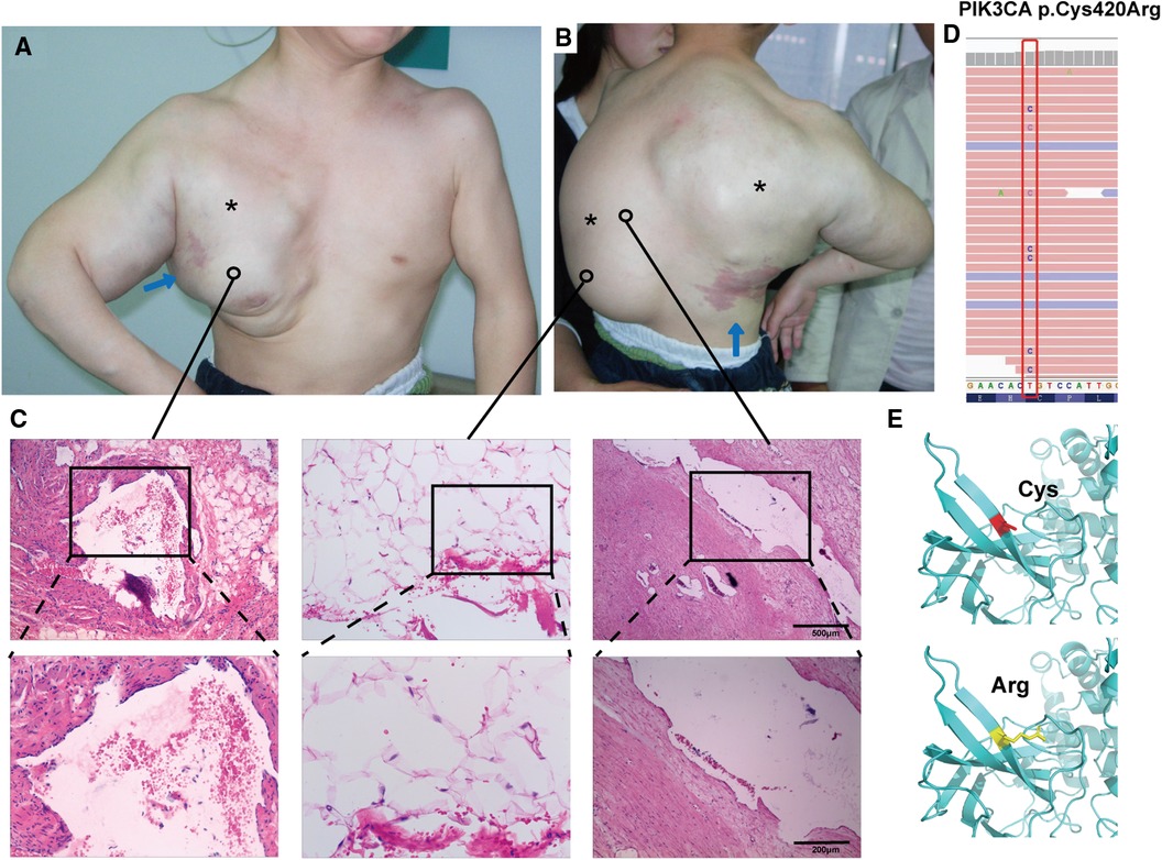 Example of male nipple scan and tracing for size measurement. Image