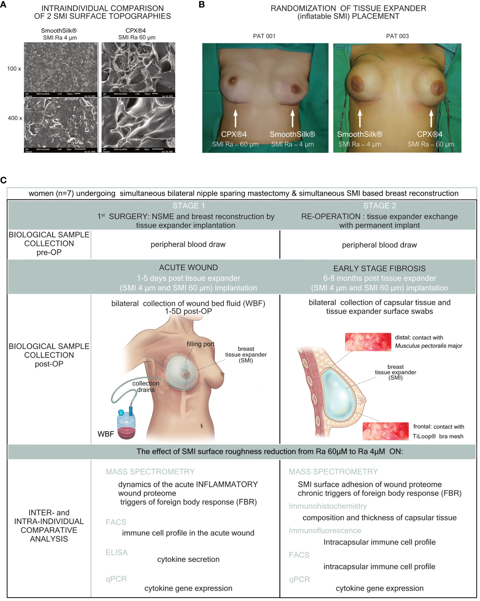 Debunked claims linking bras to breast cancer resurface online