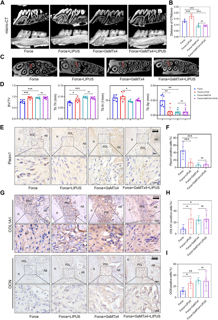 Frontiers | Low-intensity pulsed ultrasound promotes the
