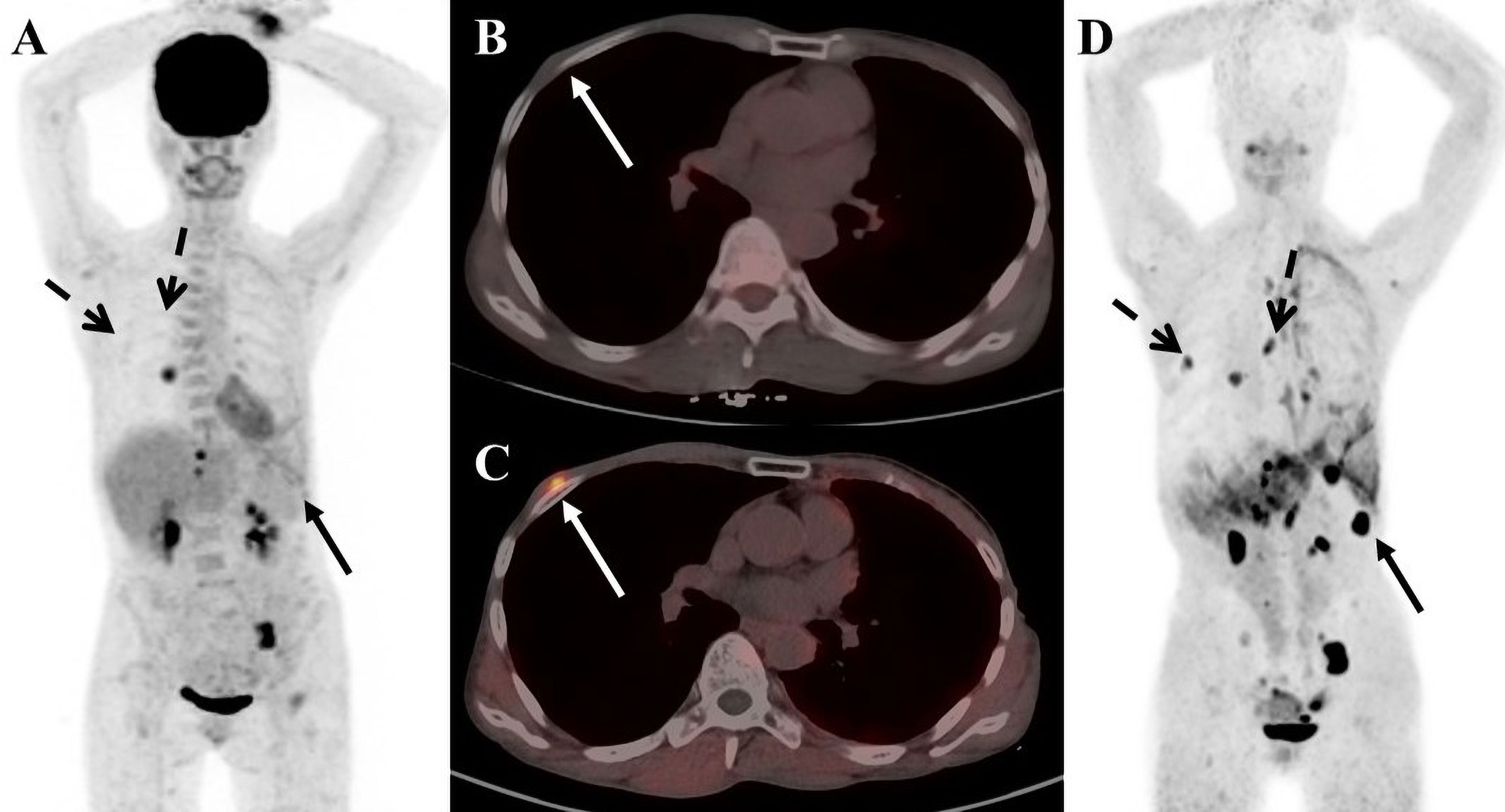 han gain fake nude Frontiers | Applications of FAPI PET/CT in the diagnosis and treatment of  breast and the most common gynecologic malignancies: a literature review