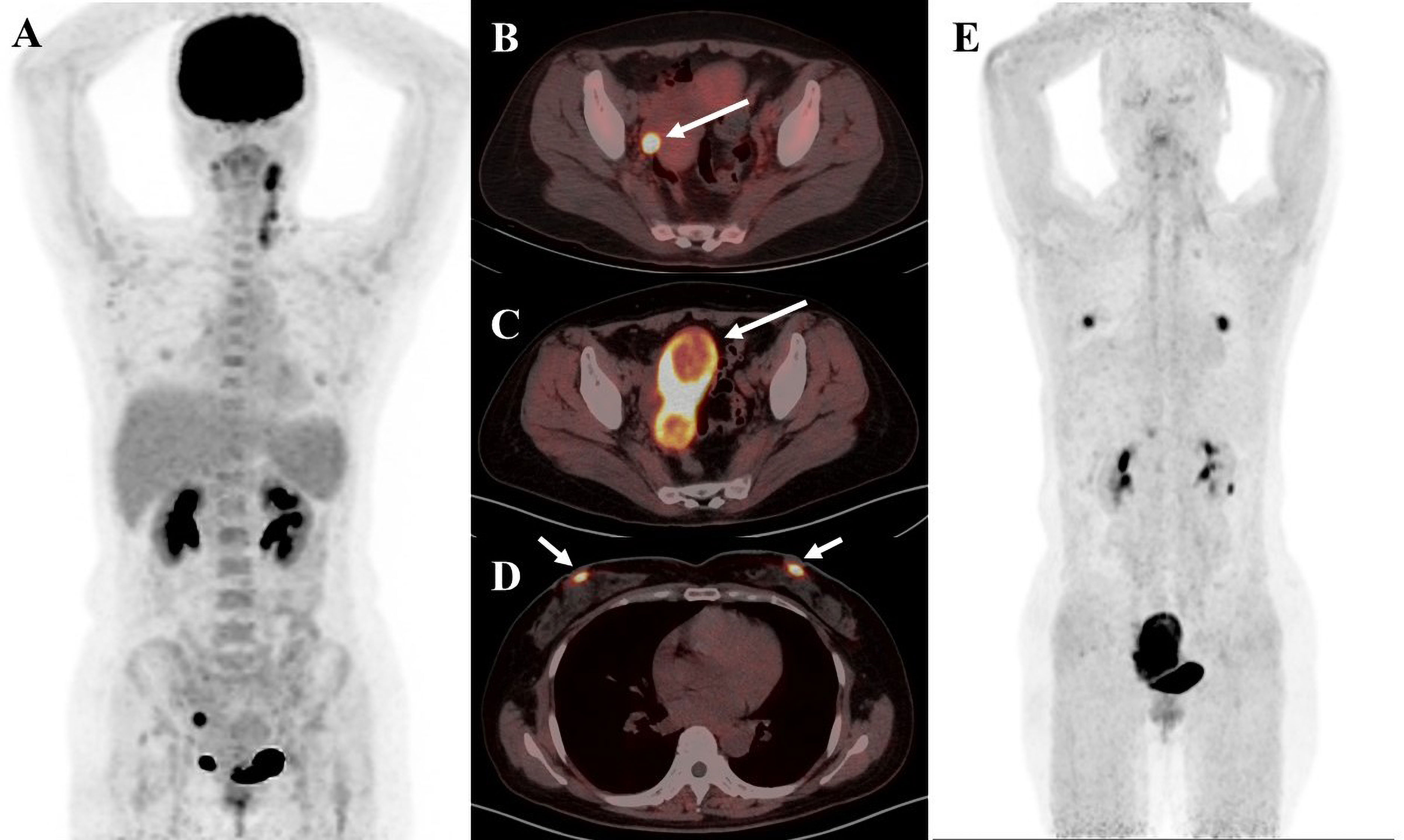 han gain fake nude Frontiers | Applications of FAPI PET/CT in the diagnosis and treatment of  breast and the most common gynecologic malignancies: a literature review