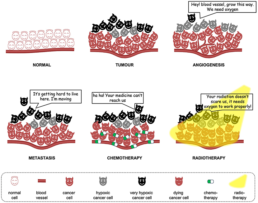 Figure 1 - The normal cells are nicely arranged and organized, while the cancer cells in a tumor are disorganized and grow wherever they want to.