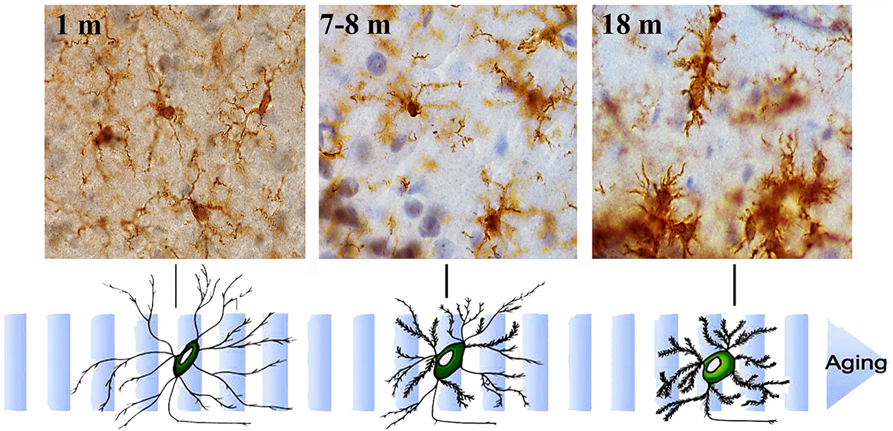 Frontiers | Microglial cell dysregulation in Brain Aging and 