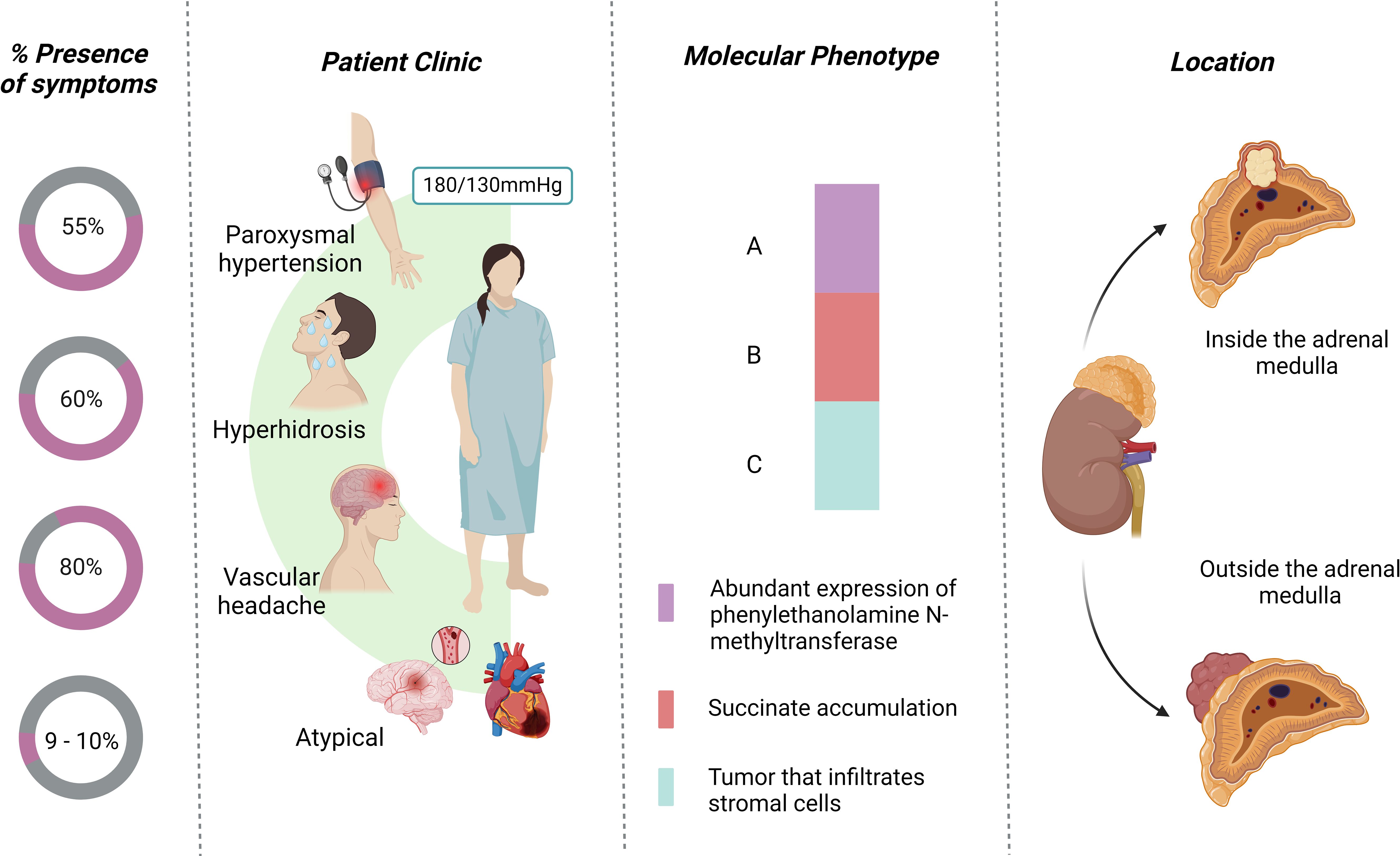 Frontiers Pheochromocytoma an updated scoping review from clinical presentation to management and treatment