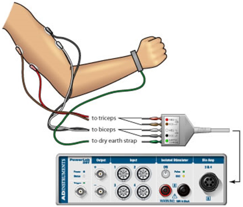 Diagram showing an arm with electrodes attached for a muscle stimulation setup. Wires connect the triceps, biceps, and an earth strap to a control unit below labeled
