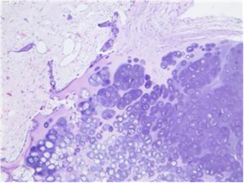 Microscopic image showing a cross-section of tissue stained in varying shades of purple. The image displays densely packed cells with darker nuclei, indicative of a histological sample.