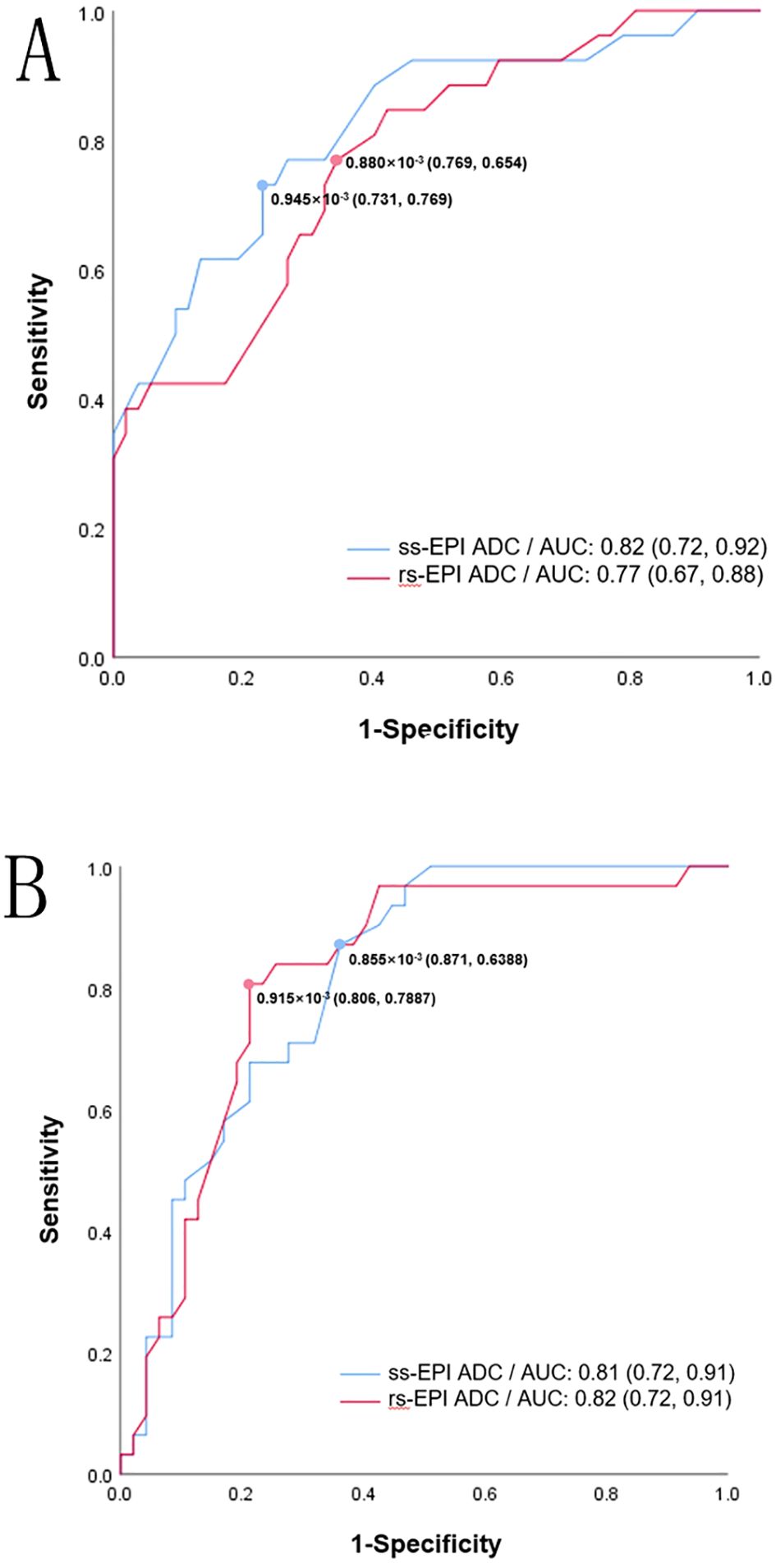 Two graphs labeled A and B depict receiver operating characteristic (ROC) curves. Both graphs plot sensitivity against 1-specificity. In graph A, the blue line represents ss-EPI ADC with an area under the curve (AUC) of 0.82 and the red line represents rs-EPI ADC with an AUC of 0.77. In graph B, the blue line represents ss-EPI ADC with an AUC of 0.81 and the red line represents rs-EPI ADC with an AUC of 0.82. Data points with specific coordinates are marked on both curves.