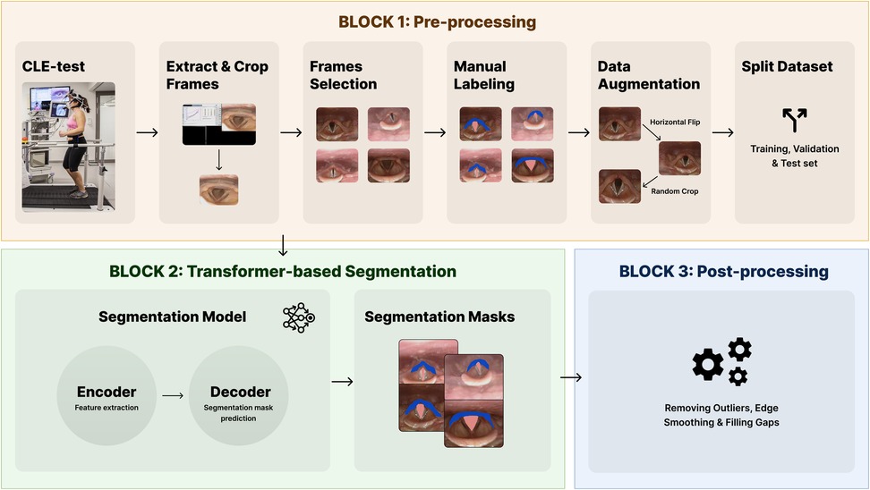 Flowchart illustrating a machine learning workflow for analyzing CLE-test data. Block 1 involves pre-processing: extracting and cropping frames, selecting frames, manual labeling, data augmentation, and splitting the dataset into training, validation, and test sets. Block 2 covers transformer-based segmentation with an encoder-decoder model producing segmentation masks. Block 3 focuses on post-processing, which includes removing outliers and smoothing edges.