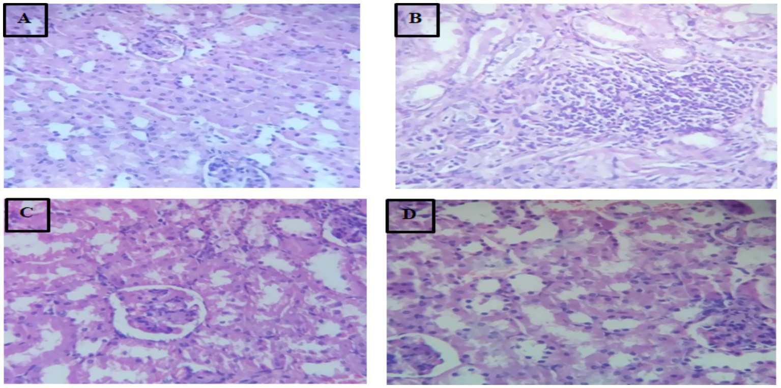 Four microscopic images labeled A, B, C, and D. Image A shows kidney tissue with normal glomeruli. Image B depicts inflammatory cellular infiltration. Image C shows glomerular damage with cellular changes. Image D displays tissue sections indicating additional alterations. Each panel highlights different pathological features.