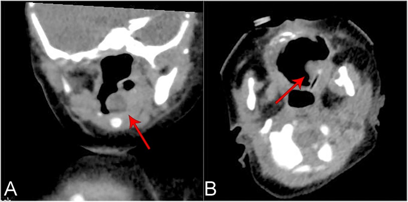 CT scan images of a head in two panels, labeled A and B. Both panels feature red arrows pointing to darker regions within the scan, likely indicating areas of interest or concern. The background is a grayscale representation of soft and dense tissues.