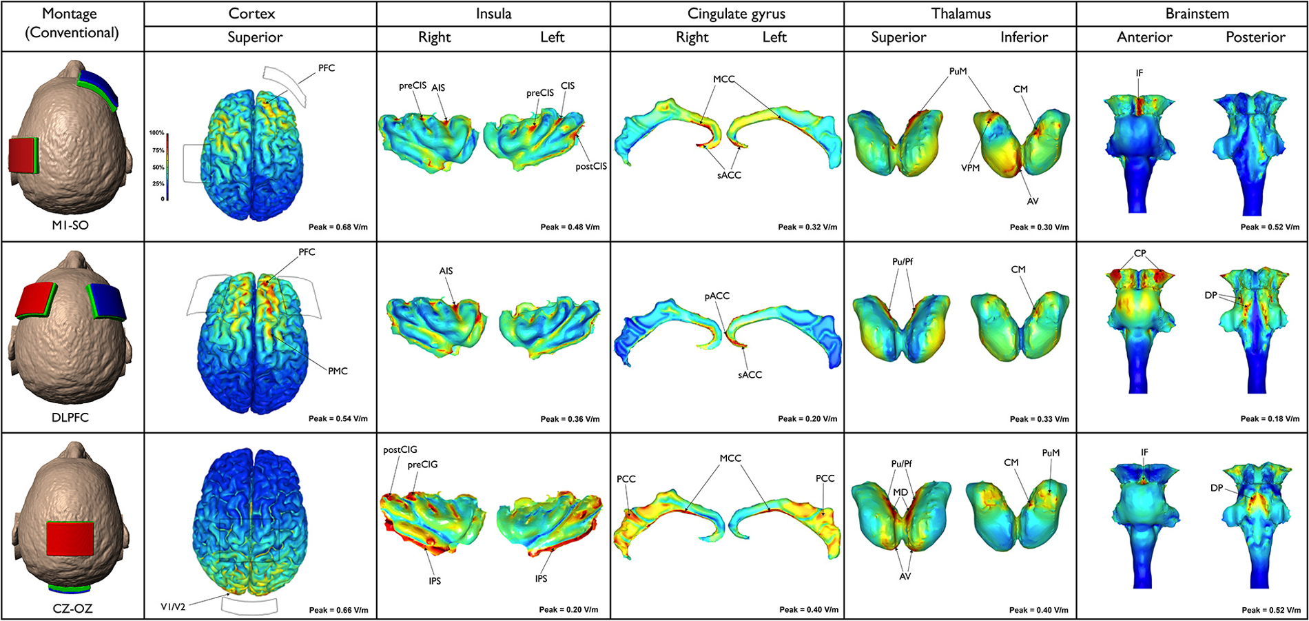 Tdcs Montage Chart