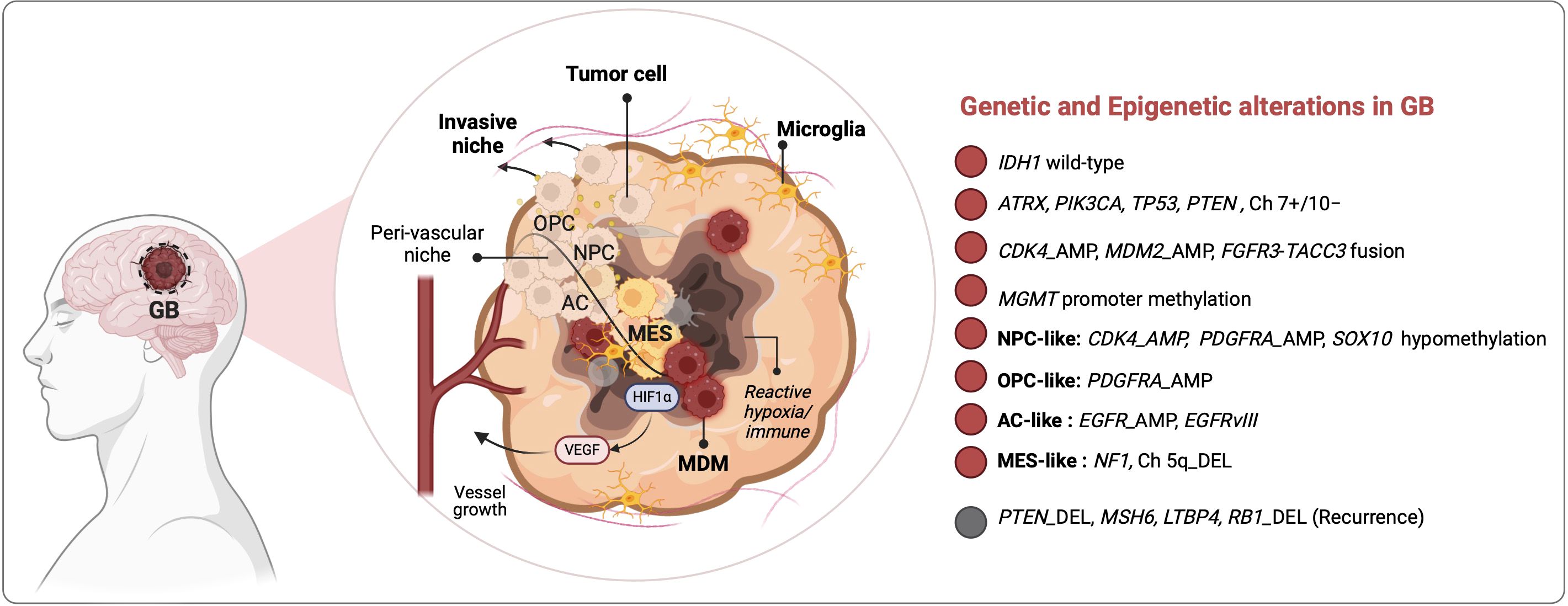 Diagram illustrating genetic and epigenetic alterations in glioblastoma (GB). It shows a cross-section of a human head with a detailed view of a tumor cell. Labels indicate different zones: invasive niche, perivascular niche, and various cell types such as OPC, NPC, AC, and MES. Genetic factors listed include IDH1, ATRX, PIK3CA, and more, with related anomalies like CDK4_AMP and MGMT promoter methylation. The diagram highlights mechanisms like vessel growth and reactive hypoxia mediated by elements like VEGF and HIF1α.