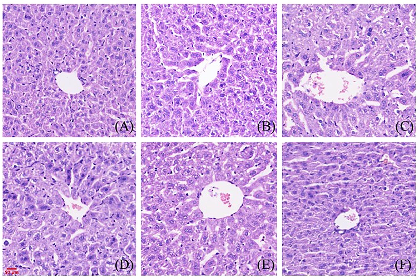 Microscopic images of liver tissue samples labeled A to F. Each panel shows liver cells with varying degrees of cell structure density and staining. Differences in cell arrangement and central vein visibility are noticeable between each image.