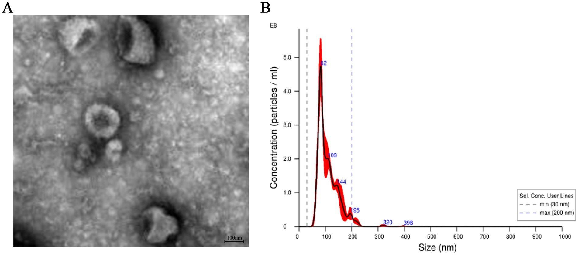 Panel A shows a grayscale microscopic image of particles on a textured background. Panel B presents a graph with particle concentration on the y-axis and size in nanometers on the x-axis. The graph depicts a concentration peak at around 100 nanometers.