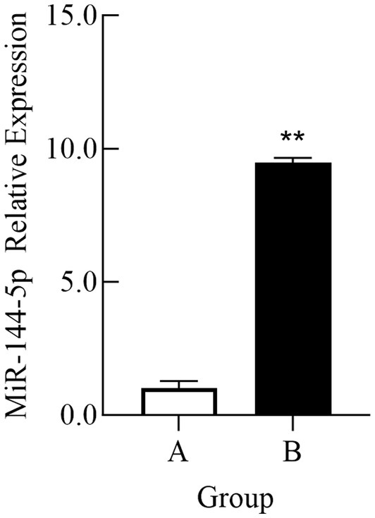 Bar graph showing the relative expression of miR-144-5p in two groups, A and B. Group A has a low expression level around 0, while Group B shows a significantly higher expression above 10, marked with asterisks indicating statistical significance.