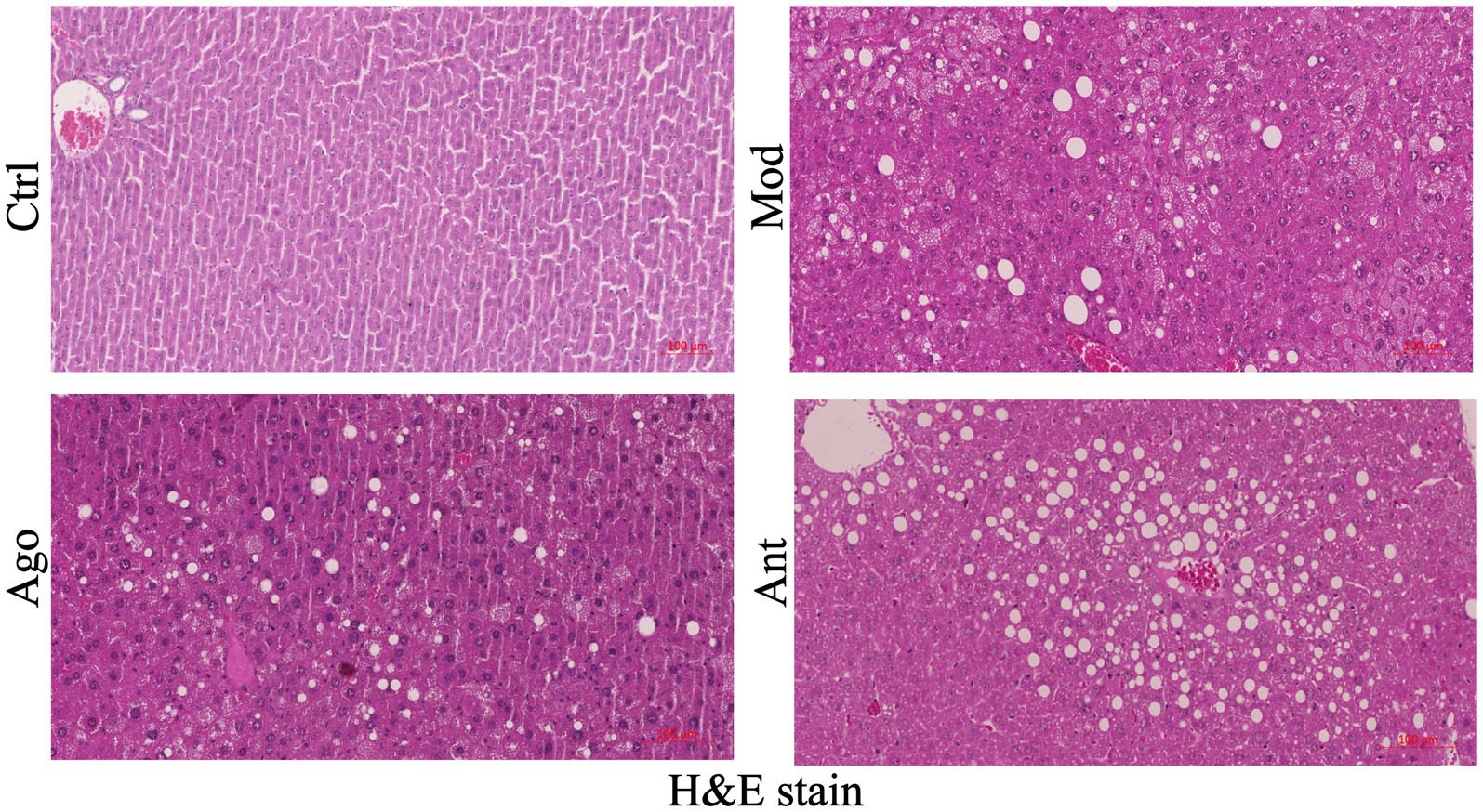 Four panels of liver tissue images stained with hematoxylin and eosin (H&E). Top-left shows normal tissue (Ctrl) with organized structure. Top-right (Mod), bottom-left (Ago), and bottom-right (Ant) show varying degrees of fat accumulation and cellular changes. White areas indicate lipid vacuoles. Magnification scale is marked at 100 micrometers.