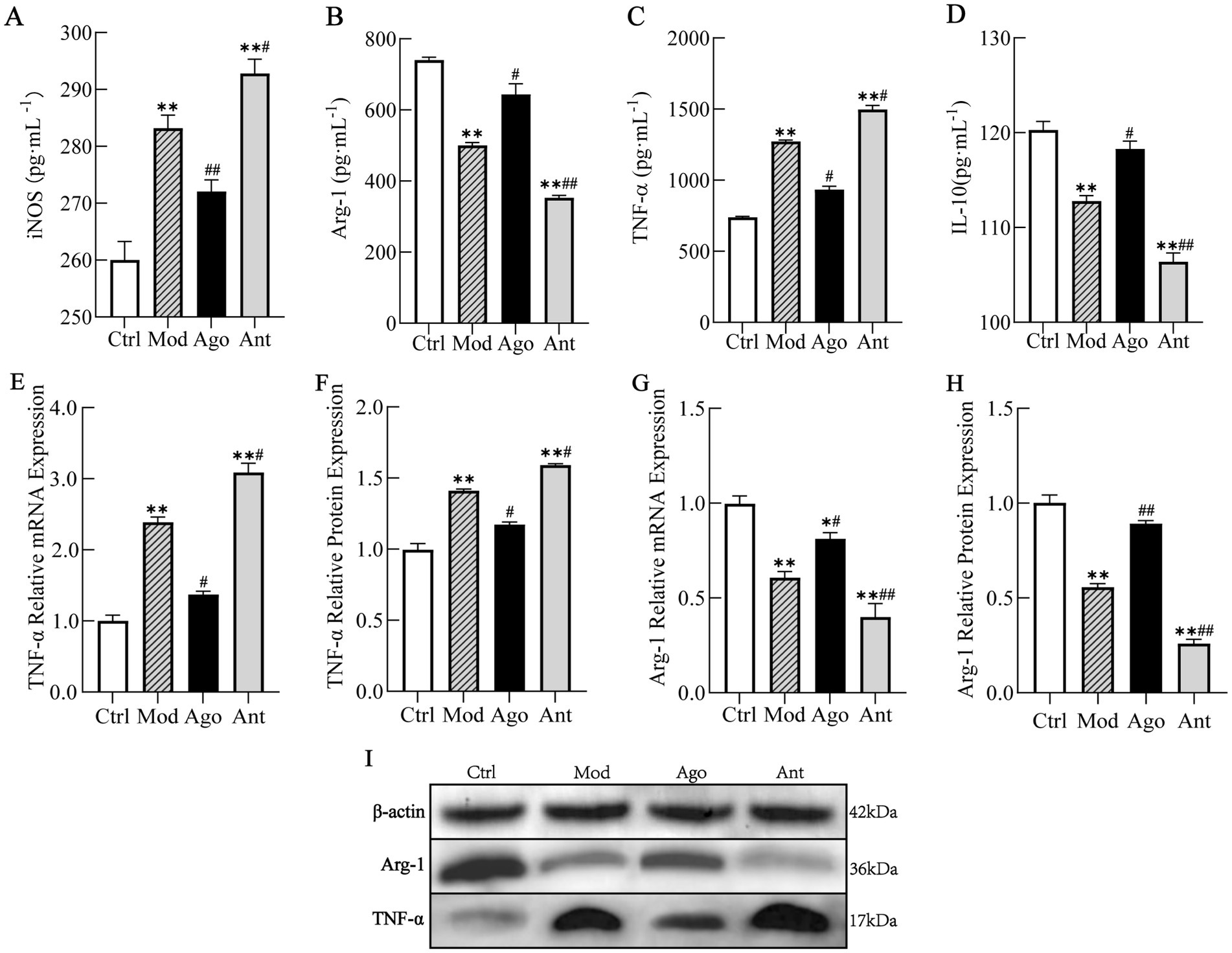 Bar graphs and a protein expression analysis showing the effects of different treatments (Ctrl, Mod, Ago, Ant) on various markers. Panels A to D display iNOS, Arg-1, TNF-α, and IL-10 concentrations. Panels E to H show relative mRNA and protein expressions of TNF-α and Arg-1. Panel I depicts western blot results for β-actin, Arg-1, and TNF-α, with molecular weights noted. Significant differences are indicated with asterisks and hashes.