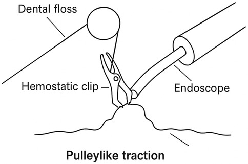 Diagram illustrating \