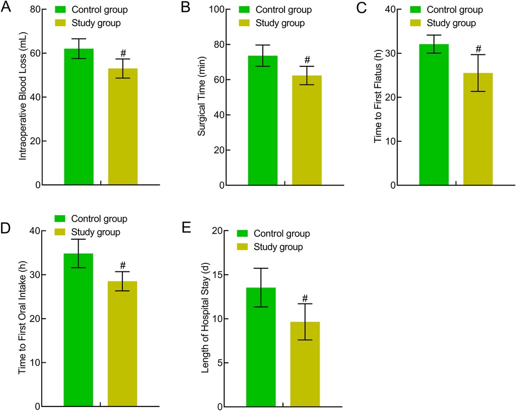 Bar charts comparing control and study groups on various metrics: (A) intraoperative blood loss, (B) surgical time, (C) time to first flatus, (D) time to first oral intake, and (E) length of hospital stay. The study group consistently shows lower values across all metrics compared to the control group, indicated with a hash symbol for statistical significance.