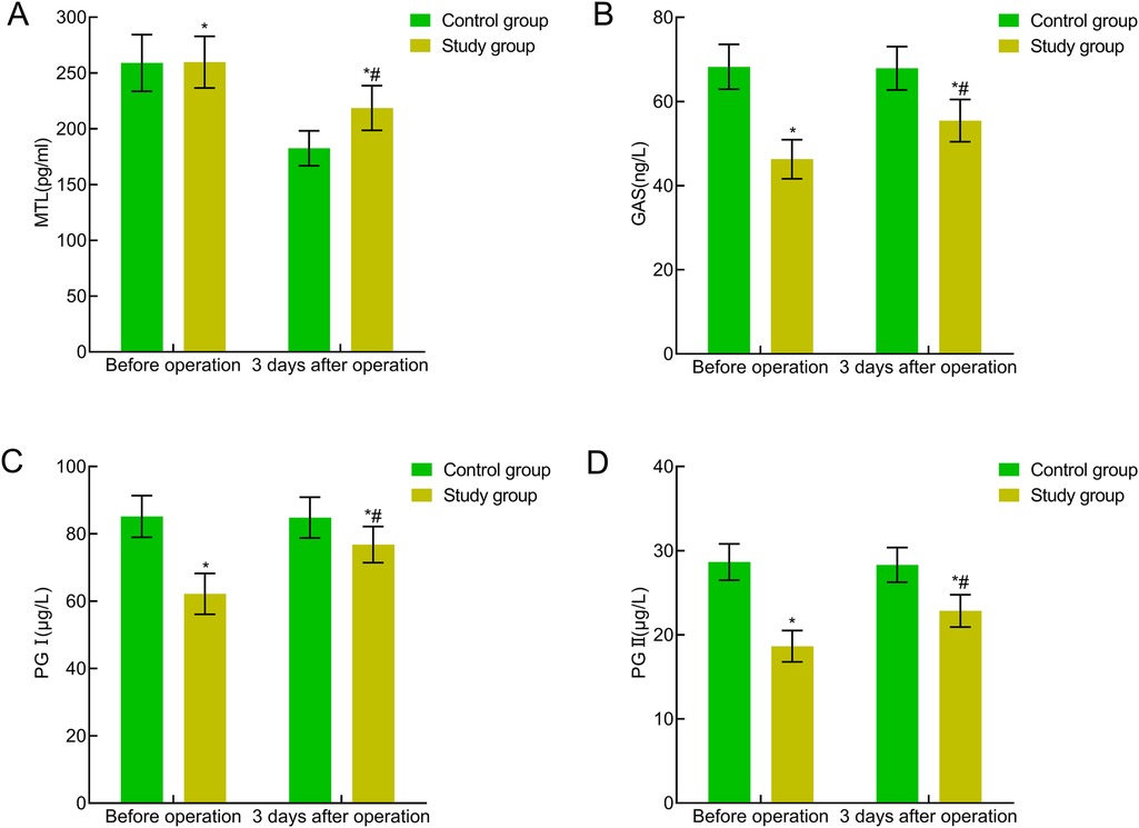 Bar charts comparing two groups before and three days after an operation. Chart A shows MTL levels, with the study group higher post-operation. Chart B shows GAS levels, decreasing in both groups post-operation with the study group lower. Chart C displays PG I levels, with the study group initially lower but rising post-operation. Chart D shows PG II levels, decreasing post-operation, with the study group initially lower but rising after the operation. Green bars represent the control group, and yellow bars represent the study group.