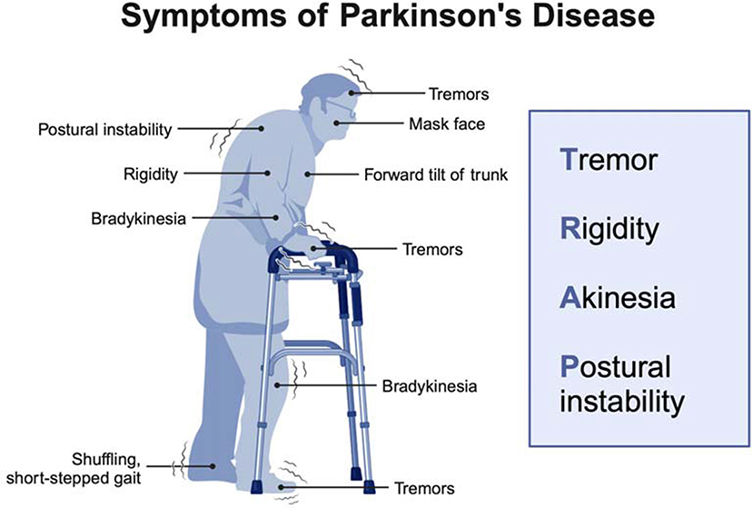 Illustration showing symptoms of Parkinson’s Disease on a person using a walker. Labels indicate tremors, masked face, forward tilt of trunk, rigidity, bradykinesia, shuffling gait, and postural instability. An adjacent box lists “TRAP” symptoms: Tremor, Rigidity, Akinesia, Postural instability.