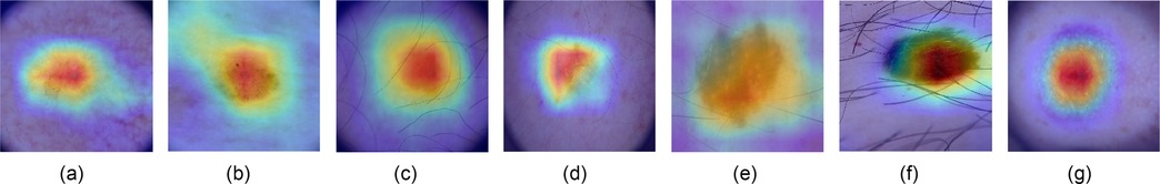 Seven images show skin lesions with varying colors and patterns, labeled as Figures 10a to 10g. Each lesion is depicted with heatmap colors, indicating different skin conditions: AKIEC, BCC, BKL, DF, NV, MEL, and VASC.