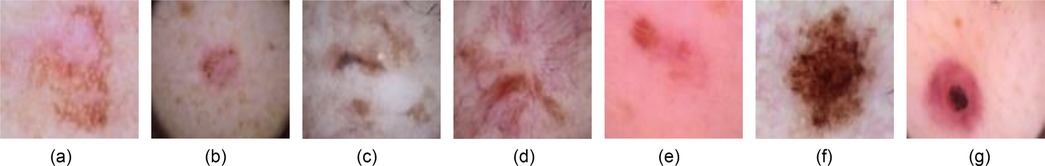 Seven images display various skin conditions labeled as follows: a) AKIEC with reddish-brown lesion, b) BCC with small pink area, c) BKL with light and dark brown patches, d) DF with a dark spot on pink skin, e) NV with reddish-brown mark, f) MEL with a dark brown irregular shape, g) VASC with a red spot surrounding a darker core.