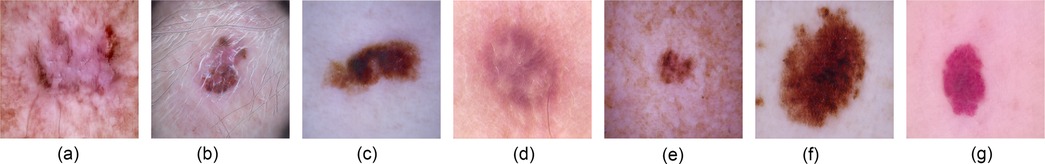 Seven close-up images of various skin lesions, labeled as follows: 5a depicts AKIEC, showing a reddish, irregular area; 5b shows BCC with a translucent, raised lesion; 5c presents BKL, a brown, pigmented patch; 5d displays DF, a pinkish, slightly raised spot; 5e shows NV with a brown, symmetrical mole; 5f depicts MEL, a dark, irregular lesion; 5g features VASC with a red, round mark.