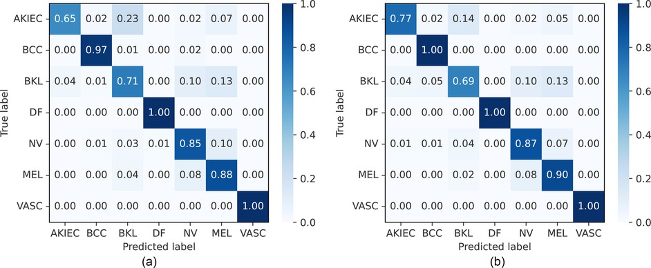 Two confusion matrices comparing feature-level fusion and decision-level fusion for classification performance. The left matrix shows feature-level fusion, highlighting high accuracy for BCC, DF, NV, and VASC. The right matrix represents decision-level fusion, indicating perfect accuracy for BCC, DF, and VASC, with improved AKIEC classification compared to feature-level fusion. Color intensity reflects classification accuracy, ranging from light (low accuracy) to dark blue (high accuracy).