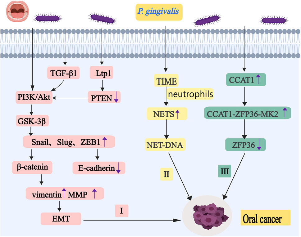 Diagram illustrating pathways related to P. gingivalis and oral cancer. The left path shows bacteria activating TGF-β1, impacting PI3K/Akt and PTEN, leading to EMT via Snail, Slug, ZEB1, β-catenin, and E-cadherin. The middle path shows P. gingivalis affecting neutrophils through TIME, increasing NETS and NET-DNA. The right path involves CCAT1, affecting CCAT1-ZFP36-MK2 and ZFP36, all contributing to oral cancer.