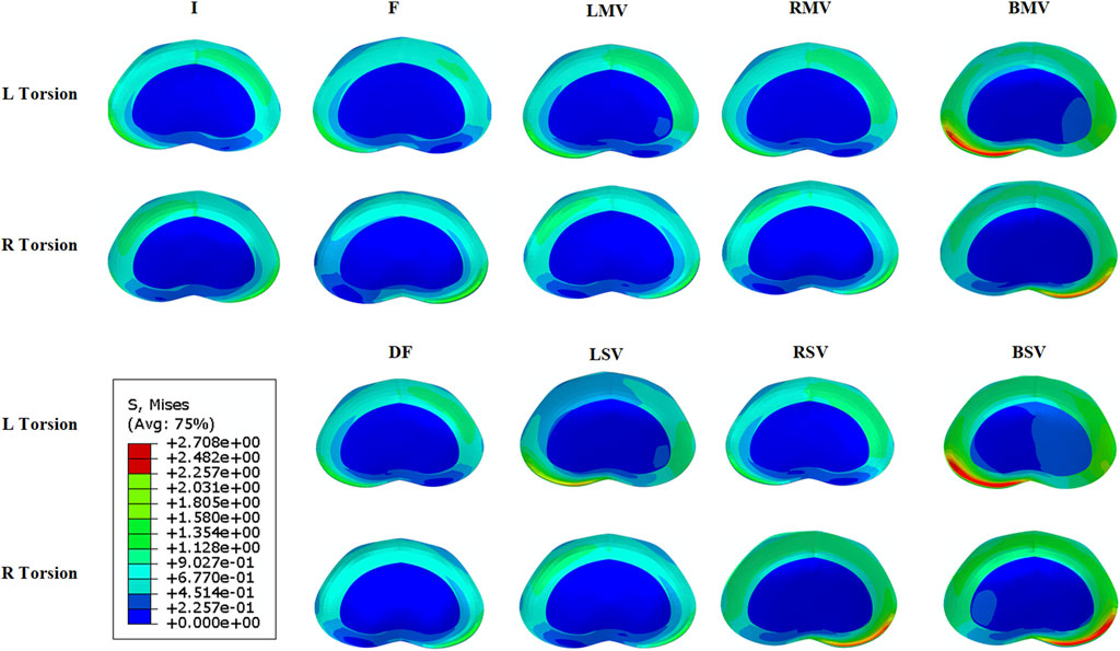 Simulation of stress distribution in a component under various conditions. Two rows show left and right torsion effects across eight models labeled I, F, LMV, RMV, BMV, DF, LSV, RSV, and BSV. Colors range from blue to red, indicating stress intensity based on a legend.