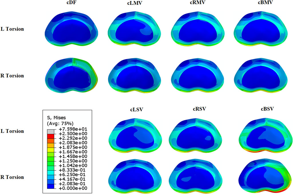 Color-coded diagrams display simulations of stress distribution under different torsion conditions labeled as cDF, cLMV, cRMV, cBMV, cLSV, cRSV, and cBSV. Each condition shows left and right torsions in two rows. The color scale ranges from red to blue, indicating varying stress levels, with blue representing lower stress and red higher stress. The legend in the lower left explains the stress values corresponding to each color.