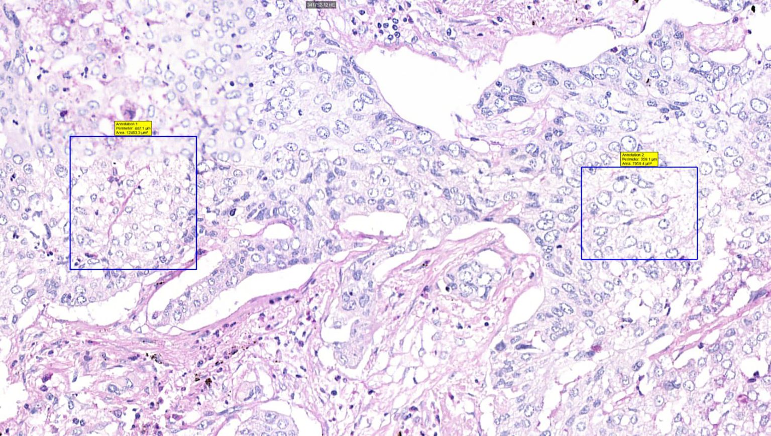 Microscopic image showing a tissue section with densely packed cells and two highlighted rectangular annotations in blue. Each annotation contains measurements of perimeter and area on a yellow label. Various cell nuclei are visible within the tissue.