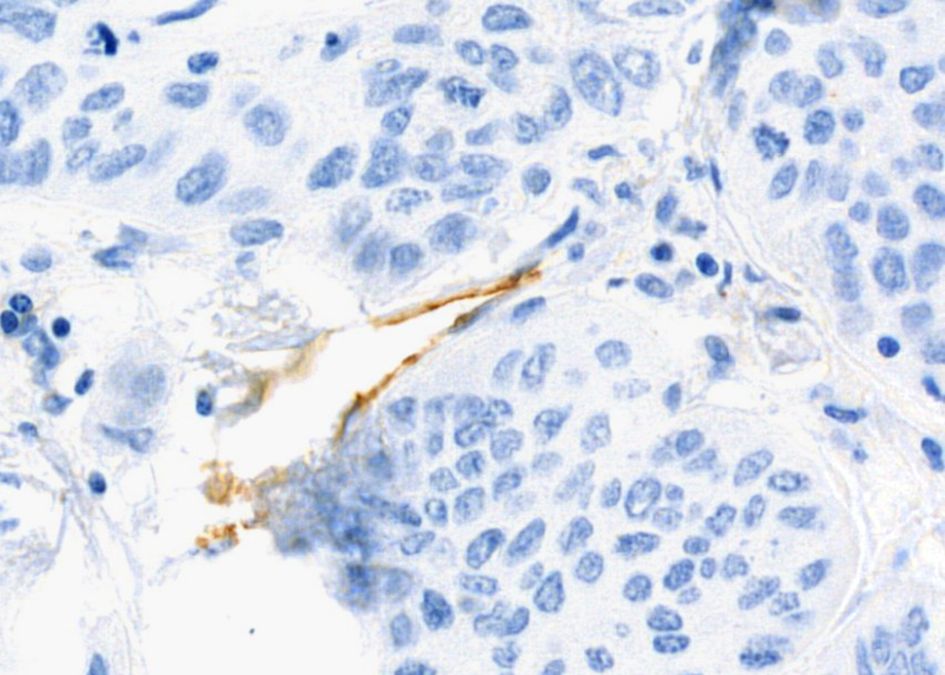 Microscopic image showing clusters of cells stained in blue, with individual oval-shaped nuclei visible. A few areas appear highlighted in a darker brown or yellowish hue, possibly indicating specific staining.