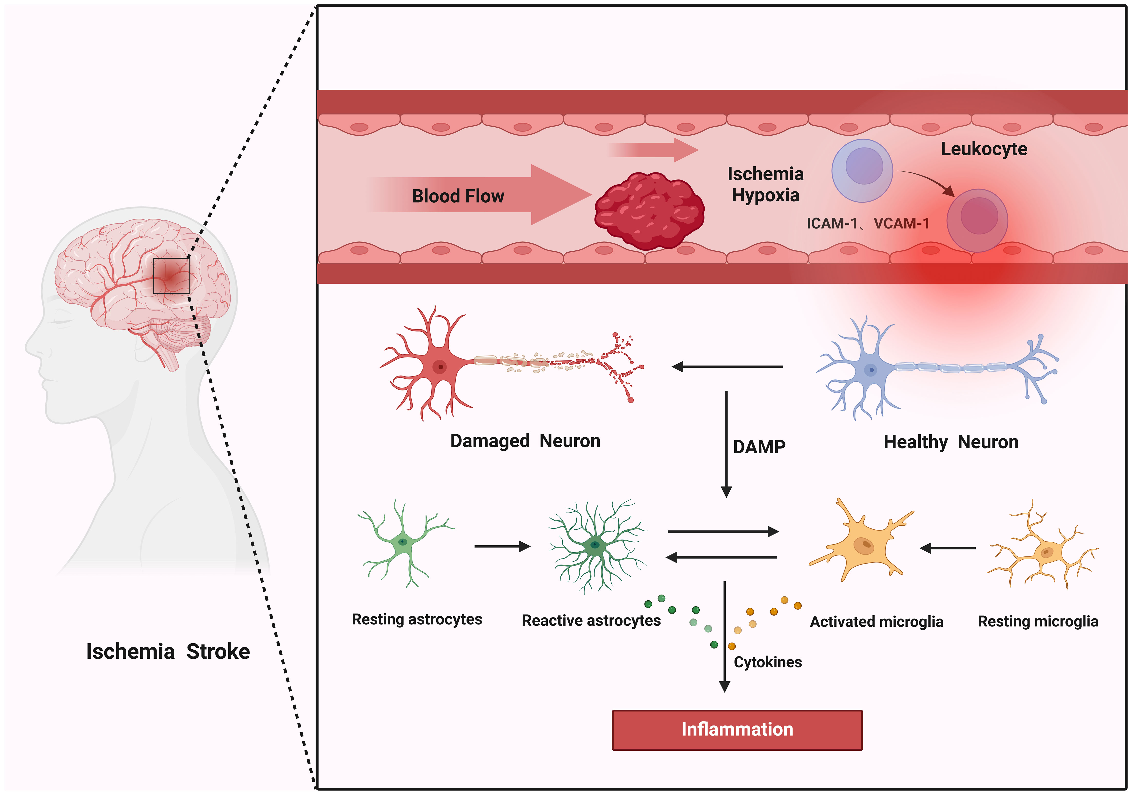 The Role of Exosomes in the Crosstalk between Adipocytes and Liver Cancer  Cells