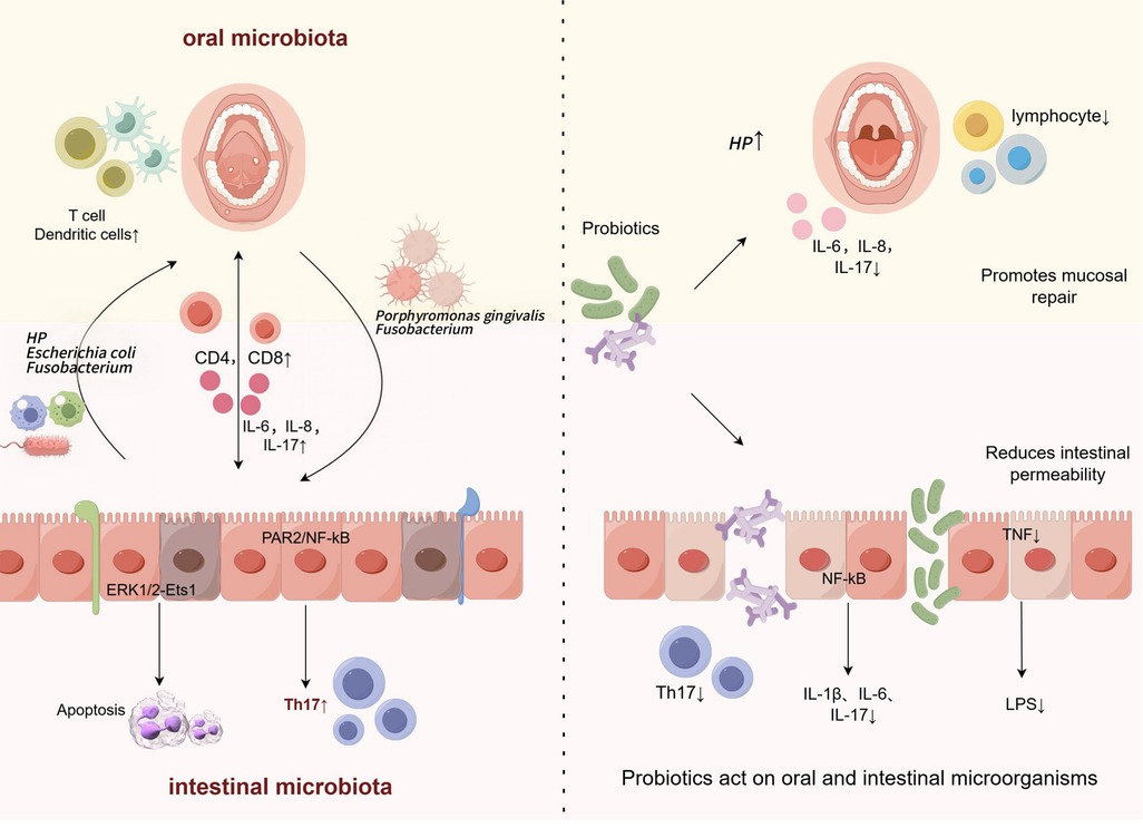 Diagram comparing the effects of oral and intestinal microbiota with and without probiotics. The left side shows harmful bacteria like Porphyromonas gingivalis and Fusobacterium affecting oral health, increasing CD4 and CD8 cells, and causing inflammation in the gut. The right side illustrates the positive impact of probiotics, reducing inflammation markers like IL-6, IL-8, and IL-17, promoting mucosal repair, and decreasing intestinal permeability. Probiotics act on both oral and intestinal microorganisms, reducing harmful effects.