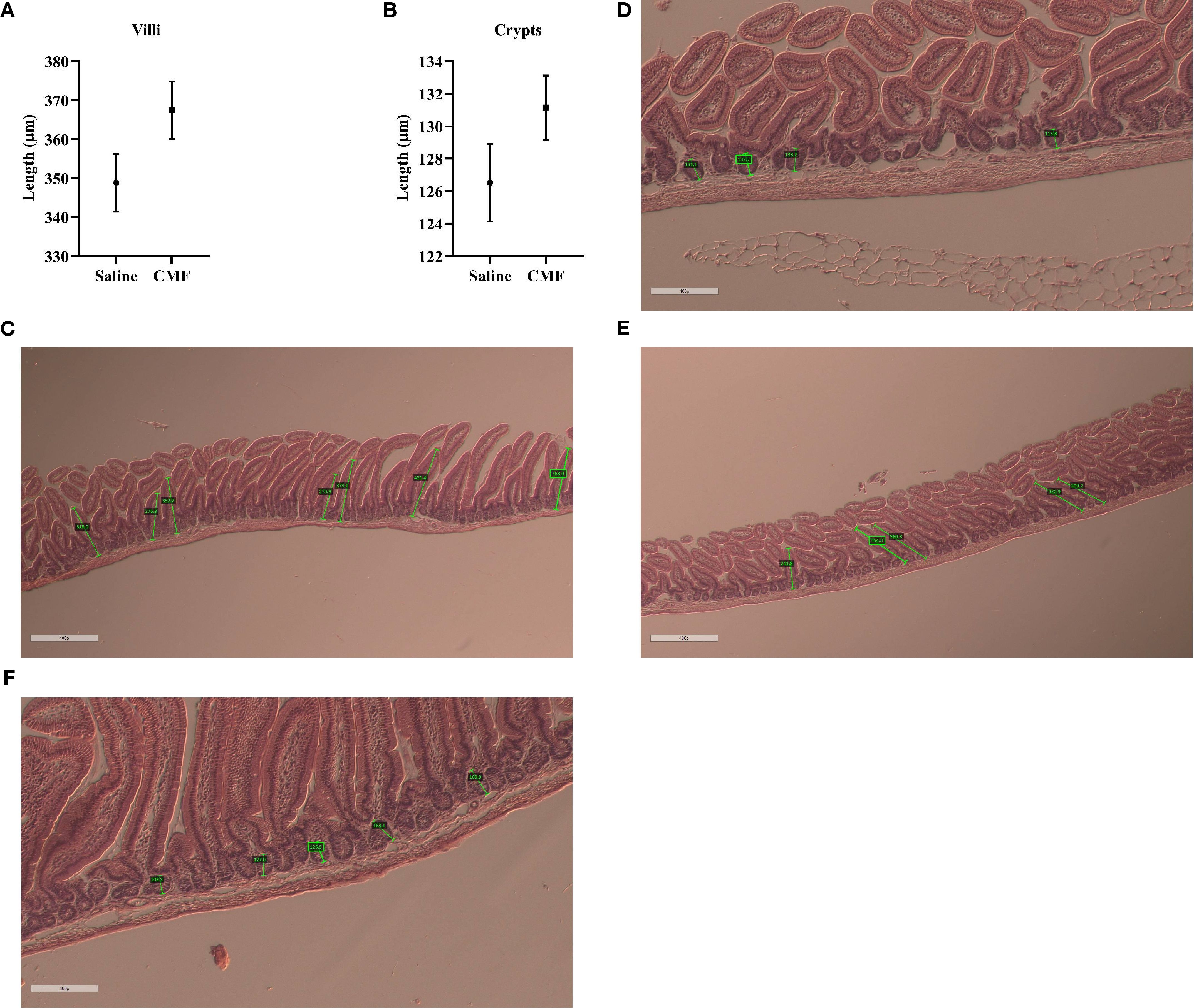 Graphs A and B show the length of villi and crypts in micrometers, comparing saline and CMF treatments with error bars. Images C to F display microscopic views of intestinal sections, highlighting the structures with green measurement labels. Each section shows varying lengths and formations of the villi and crypts.