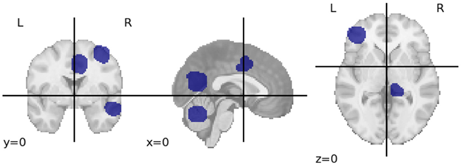 Three brain scans in different orientations show highlighted regions in blue. The left scan has y=0, showing front view; the middle scan has x=0, showing side view; the right scan has z=0, showing top view. Labeled with coordinates L and R for left and right.