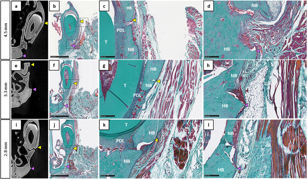 A series of micro-CT and histological images showing dental structures of the three different defect sizes: 4.5mm, 3.3 mm, and 2.8 mm. Each row depicts a progression from amicro-CT scan to detailed histological slices, highlighting tissues like tooth (T), periodontal ligament (PDL), new bone (NB), healing bone (HB), and gingiva (Gi). Yellow and purple arrowheads point to specific regions of interest.