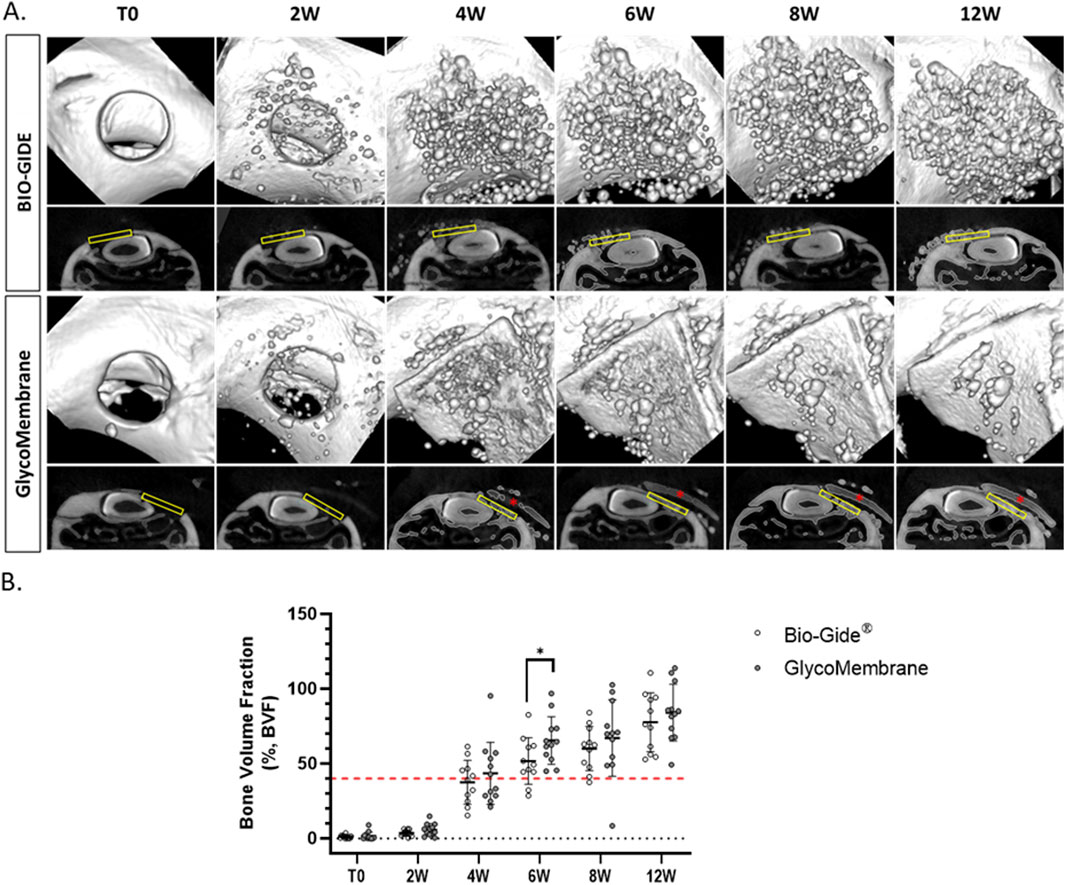 A. A series of images showing bone tissue regeneration over different time points (T0, 2W, 4W, 6W, 8W, 12W) using BIO-GIDE and GlycoMembrane. Each set has surface views and cross-sections highlighting material interaction with tissue.B. A graph displaying bone volume fraction over time for BIO-GIDE and GlycoMembrane. The x-axis represents time points and the y-axis shows bone volume fraction percentage. BIO-GIDE and GlycoMembrane data are marked with open and filled circles respectively. The red dotted line indicates a threshold at 40%, with a significant change noted at 6W.