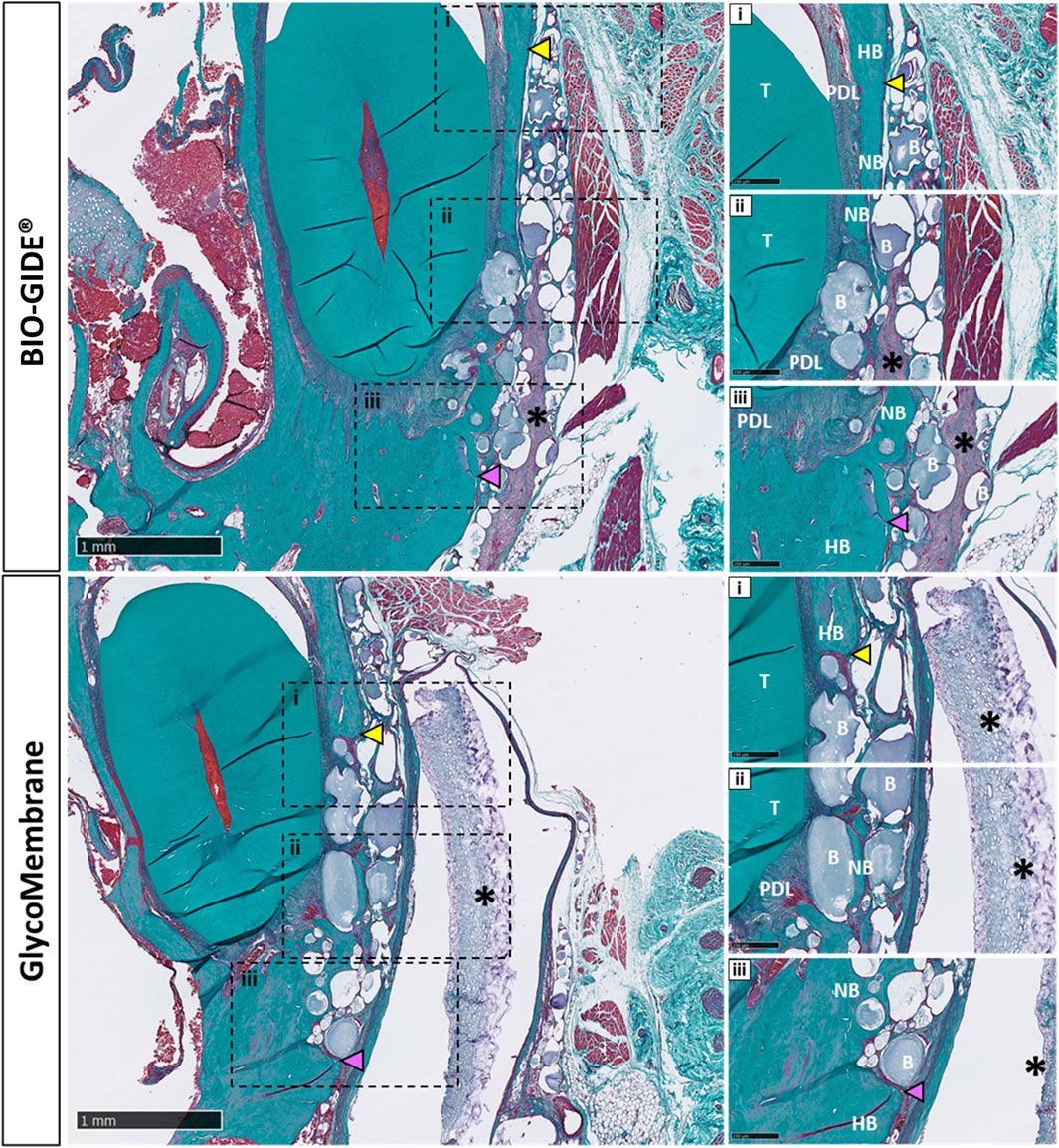 Microscopic images show two different biomaterial membranes in tissue sections labeled BIOGIDE and GlycoMembrane. Each section contains a larger overview and three detailed insets labeled i, ii, and iii. Structures include connective tissue, bone, and periodontal components with various structural and cellular compositions. Indicators like arrowheads and asterisks highlight specific features in the images. Scale bars indicate 1 millimeter.