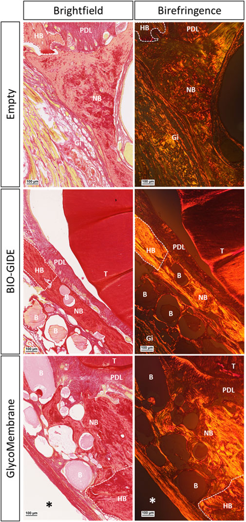 Histological images comparing tissue under brightfield and birefringence microscopy. The columns depict three conditions: Empty, Bio-Gide, and GlycoMembrane. Key labels include HB (host bone), NB (new bone), PDL (periodontal ligament), and Gi (gingiva) across different sections. Brightfield images show tissue morphology, while birefringence highlights collagen structures. Scale bars indicate 100 micrometers.