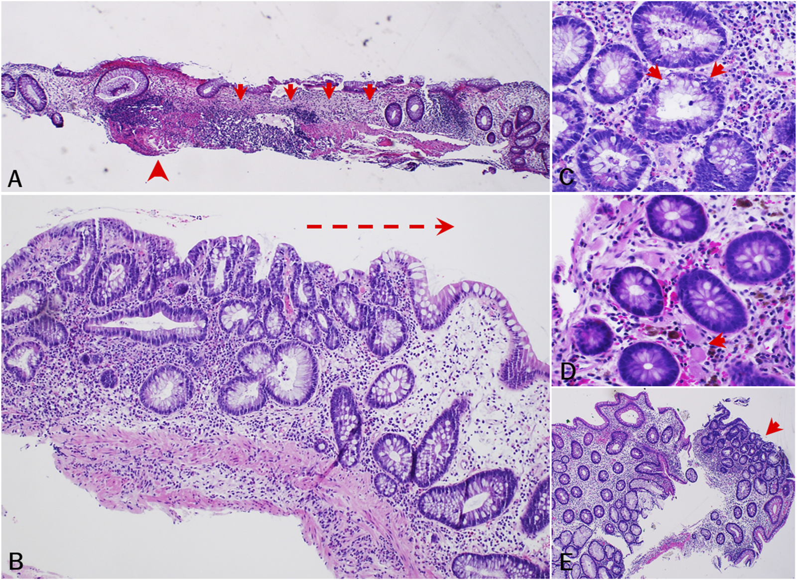 Histological images of colon tissue sections in various magnifications. Section A shows elongated tissue with arrowheads indicating specific regions. Section B displays a detailed view of intestinal glands and connective tissue. Sections C and D highlight close-up cellular structures with arrows pointing to specific cells. Section E presents an overview with an arrowhead marking a particular area. The tissues are stained in shades of purple and pink.