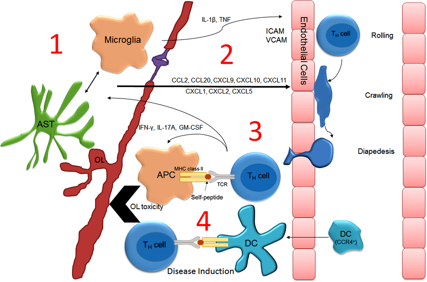 MS Attack (Relapse): Symptoms, Triggers, What To Do